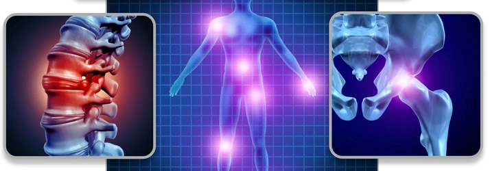 Chiropractic Apopka FL Conditions hree visuals showing an inflamed spine, a body silhouette with highlighted pain points (neck, lower back, hips, knees), and a close-up of hip joints.